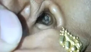 פנתה לרופא עקב כאבי ראש וגילתה שחרק פלש לאוזנה